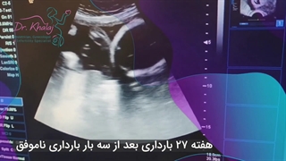 درمان نازایی بعد از سه بارداری ناموفق
