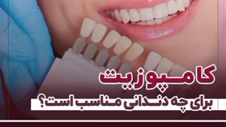 کامپوزیت برای چه دندانی مناسب است؟
