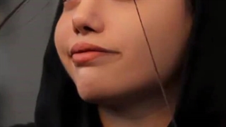 نتیجه عمل بینی بعد از گذشت یکسال از عمل