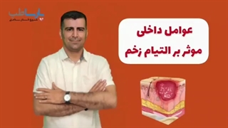 عوامل داخلی موثر در درمان زخم