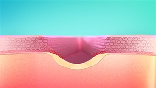 کرم سیکالفیت پلاس اون  Cicalfate | فروشگاه گیسو