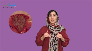 عوامل موثر بر التیام زخم