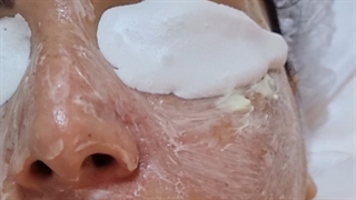 پاکسازی پوست در رشت