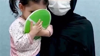 بهبود کامل انحراف چشم با جراحی | دکتر آرش میرمحمد صادقی جراحی بینی
