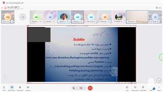 تشنج نوزادی