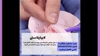 بهترین دکتر تزریق چربی به واژن پالپوتومی
