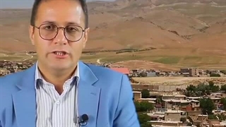 دکتر احسان غفاری فارسانی پر کردن دندان