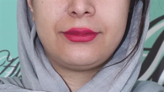 لیپوماتیک غبغب | دکتر علی الستی