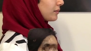 قبل و بعد از جراحی زیبایی بینی