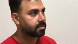 یکسال بعد از عمل بینی 