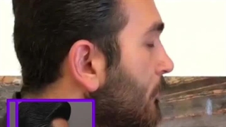 قبل و بعد از جراحی زیبایی بینی