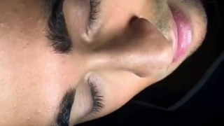 جراحی زیبایی بینی