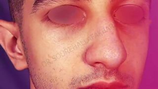 بینی طبیعی و مردانه