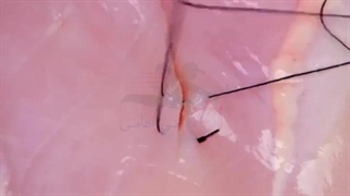 روش و تمرین بخیه زدن زخم های عمیق با آنی حامی Ani Hami