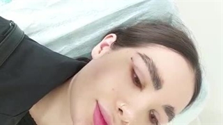 یک هفته بعد از بلفاروپلاستی