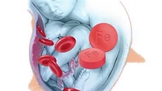 عوارض و کمبود آهن در بارداری