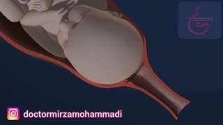 می‌دونی زایمان طبیعی چجوریه؟؟