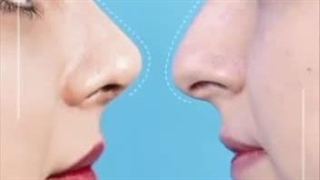 عمل بینی قوس دار به شکل طبیعی