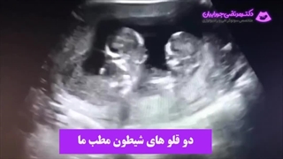 فیلم سونوگرافی دوقلوها