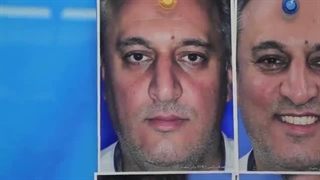 جراحی همزمان اندوسکوپی و رینوپلاستی(قسمت دوم)