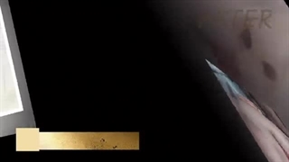 ترمیم مجدد شکاف لب