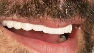 رضایت بیمار ایمپلنت: کلینیک دندان پزشکی دکتر دهقان