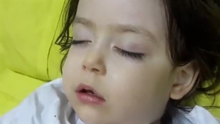 انسداد تنفسی به علت لوزه بزرگ