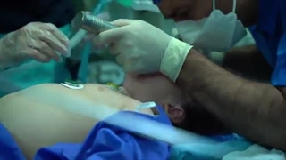 جسم خارجی ریه اطفال