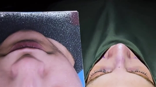 قبل و بعد از جراحی بینی اولیه