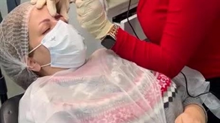 آموزش ریموو تاتو ابرو در بهترین مرکز ریمو ابرو در تهران