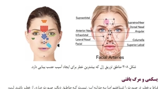 مناطق پر خطر برای تزریق فیلر