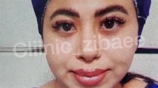 مرکز تخصصی کانتوپلاستی و بلفاروپلاستی در تهران