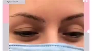 اولین مرکز کاشت ابرو در ایران - کلینیک تندیس