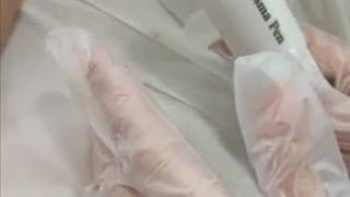 برداشتن زگیل های ناحیه تناسلی