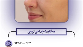 رینوپلاستی