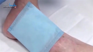 پانسمان طباگرن تریتا