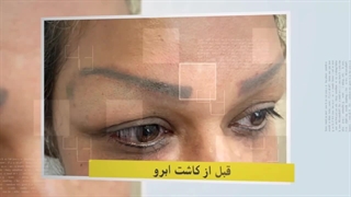 برای کاشت ابرو از کجا مو‌ برمیدارن