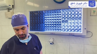 جراحی تومور مثانه بدخیم سیستم ادراری