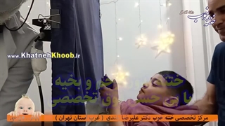 بهترین تکنیک ختنه کودکان ۲ تا ۶ ساله - کلینیک تخصصی ختنه دکتر بلندی
