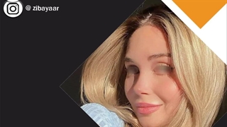 نمونه جراحی بینی گوشتی