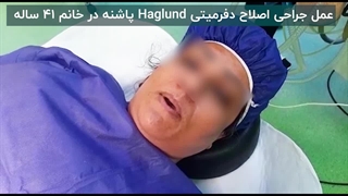 عمل جراحی اصلاح دفرمیتی haglund پاشنه در خانم ۴۱ ساله