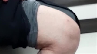 یکماه پس از تعویض مفصل زانو