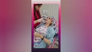 پی آر پی (PRP) مو و صورت و دست جوانسازی پوست