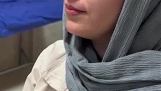 پنج ماه بعد از عمل جراحی زیبایی بینی ، طبیعی ونچرال