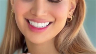 16 واحد لمینت سرامیکی فک بالا و پایین