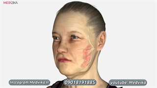 جراحی لیفت صورت در مشهد
