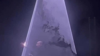 لیزرشو حرفه ای شرکت نورپیما