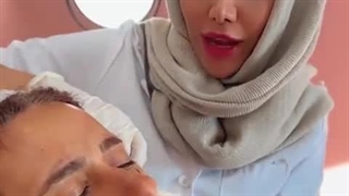 تزریق ژل گونه توسط دکتر تفت