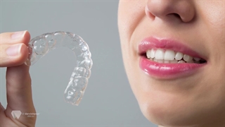 مزایا ارتودنسی نامرئی نسبت به ارتودنسی سیمی