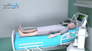 زخم بستر - علل، علائم و نشانه ها